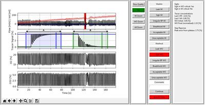 A computerized tool for the systematic visual quality assessment of infant multiple-breath washout measurements